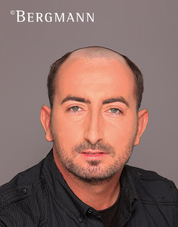 vorher